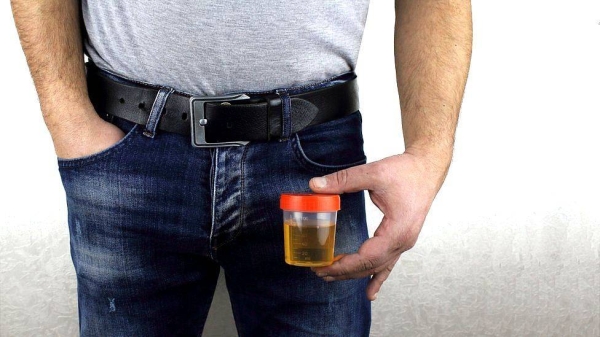Urine bugs may be a sign of aggressive prostate cancer